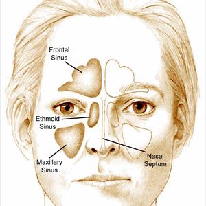 Sinus Chakra - Treating Sinusitis With Safe Finess Sinus Treatment