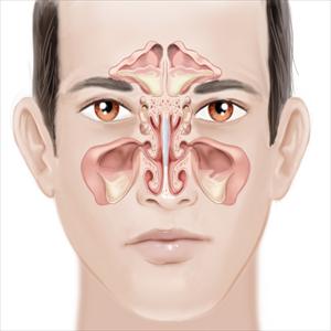 Swollen Sinus Remedy - Remedy For Negative Breath At The Back Again In The Throat A Result Of Sinusitis