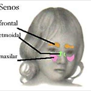 Fungal Ear Infection Dizziness - Maxillary Sinusitis - Symptoms And Treatment