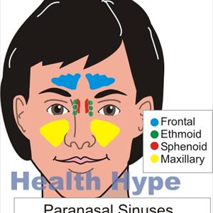 How To Clear Sinusitis 