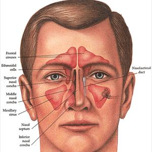 Sinus Back Drip - How To Prevent Fungal Sinusitis